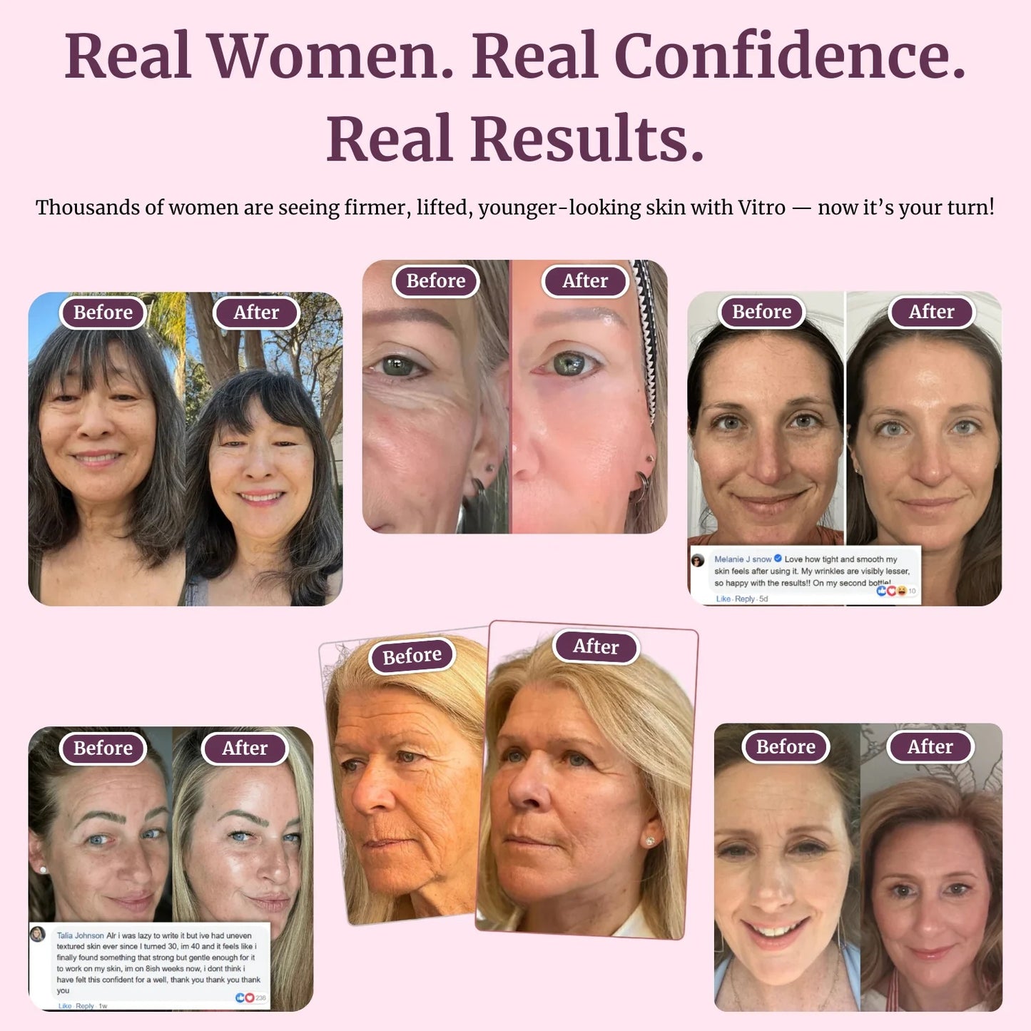 Collagen Glow Up Balm 2.0